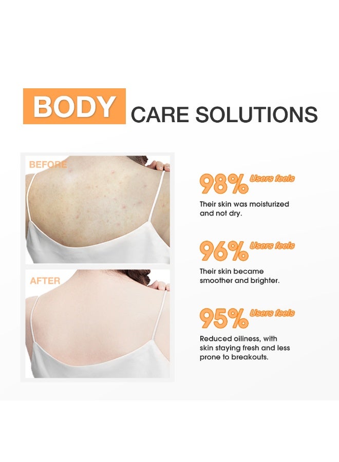 سكينيفر SKINEVER Salicylic Acid Exfoliating Body Lotion – Lightweight & Smoothing | Clear Skin for Body - Image 5