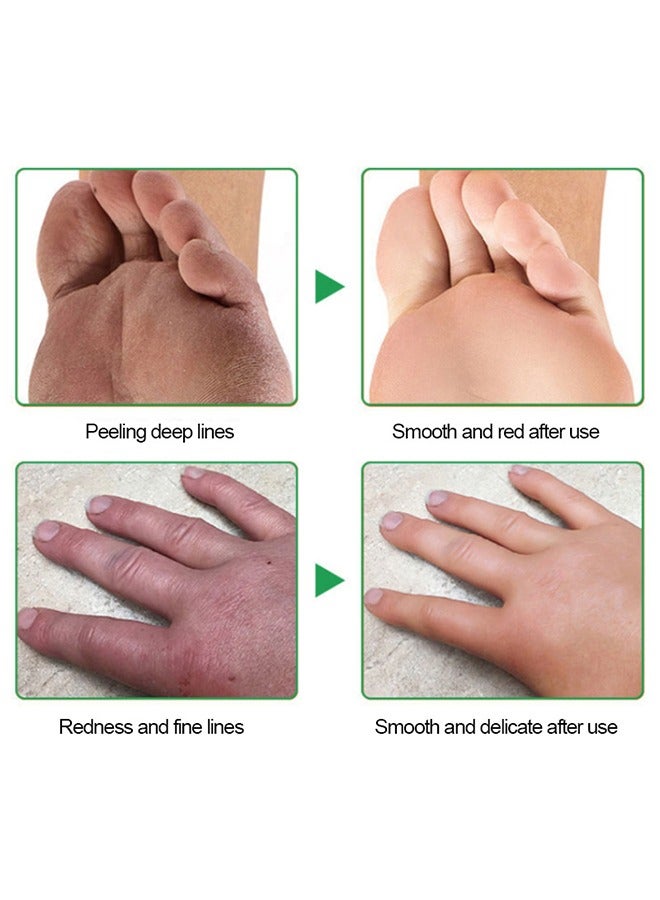 سوميفون كريم متصدع القدمين ، كريم مرطب مضاد للتشقق للقدمين واليدين ، كريم متصدع للقدمين ، كريم إصلاح القدم للكعب الجاف المتصدع ، مرهم شفاء الجلد ، يعزز مستويات الرطوبة على الفور ، يقوي حاجز البشرة 20 جرام - Image 5