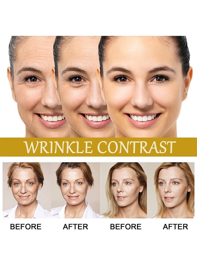 جايسوينغ مصل سم النحل المضاد للنحل ، مصل مضاد للتجاعيد مضاد للشيخوخة مع ببتيد متعدد ، حمض الهيالورونيك ، إصلاح مصل ثلاثي المفعول ، ترطيب بشرة الوجه وشدتها - Image 5