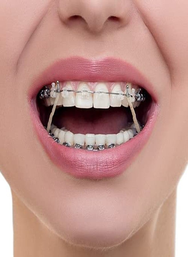 Dentosmile Orthodontic Extraoral Latex Elastics | Dental elastics| Tooth Colours Pack of 100 Pcs + Free Placer for Braces - Image 4