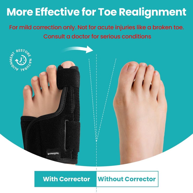 Promifun Toe Splint for Broken Toes - Big Toe Splint for Women & Men - Support Brace for Day & Night Use - Bunion Corrector - 1 Pair - Image 2
