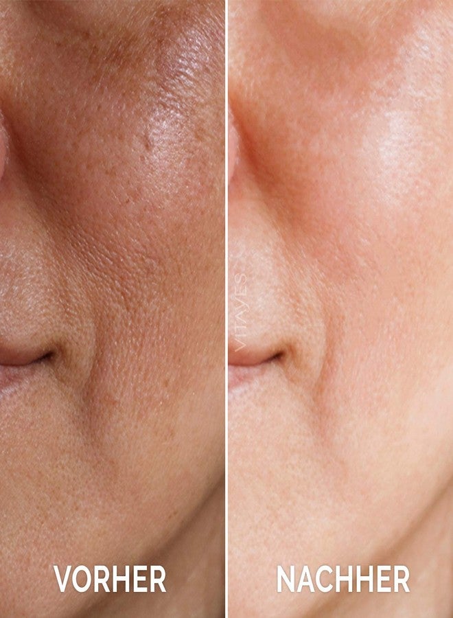 VITAYES Vitamin C Face Serum Anti Aging Serum with Hyaluronic Acid Skin Hydrating & Brightening for Dark Spots, Fine Lines and Wrinkles 1 Oz. - Image 4