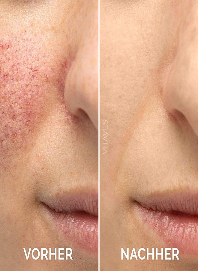 VITAYES Vitamin C Face Serum Anti Aging Serum with Hyaluronic Acid Skin Hydrating & Brightening for Dark Spots, Fine Lines and Wrinkles 1 Oz. - Image 2