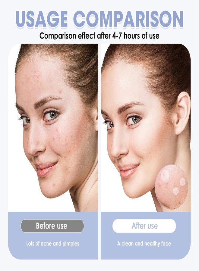 YUEWEESER Pimple Patches for Face, 720 Count 2 Size Acne Patches Day and Night, Hydrocolloid Patch Pimple Stickers for Face and Skin Patch Covering Blemishes (Skin tone & transparent colour - Image 4