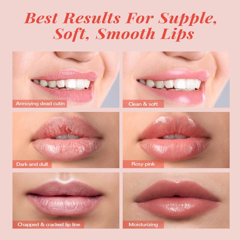 ANAI RUI Stocking Stuffers Lip Mask Set, Lip Scrub & Lip Butter, Overnight Lip Treatment Set Enriched With Skin Softening Ceramide & Watermelon and Hydrating Shea Butter, For A Softer & Smoother Pout - Image 5