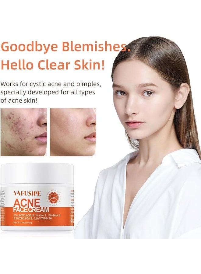 YAFUSIPE Acne Treatment for Face, Acne Cream Back Acne Treatment Cream for Teens & Adults - Image 5