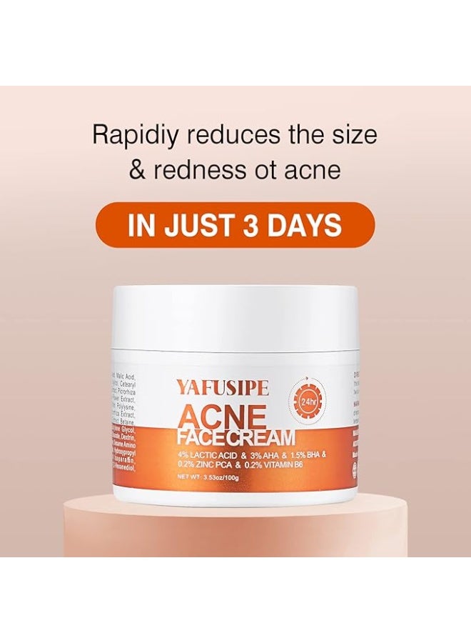 YAFUSIPE Acne Treatment for Face, Acne Cream Back Acne Treatment Cream for Teens & Adults - Image 1