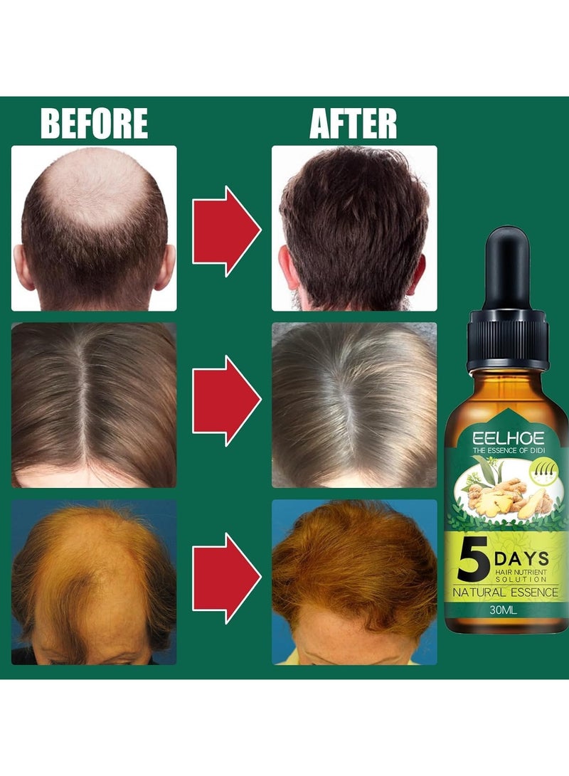 EELHOE Essence Hair Growth Oil, Hair Growth Serum Anti Hair Loss Hair Growth Serum Natural Herbal Essence Hair Serum, Hair Regrowth Essence 1PC - Image 2
