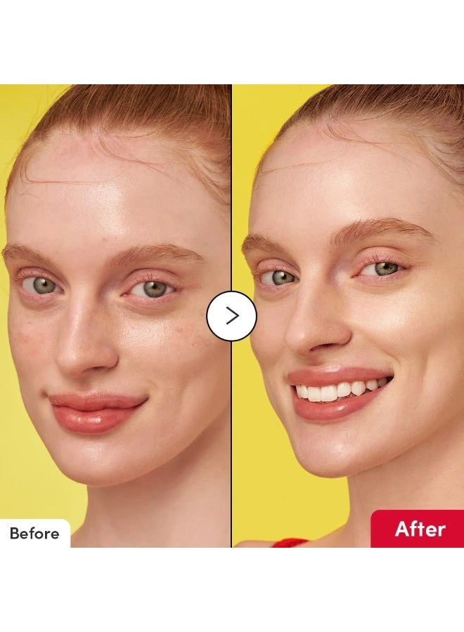 إيكوالبيري سيروم تفتيح البشرة بفيتامين C من ايكوالبيري: سيروم تفتيح بمركبات اسيرولا ونياسيناميد لتقوية حاجز البشرة وترطيبها بالسيراميد وحمض الهيالورونيك، 30 مل - Image 5