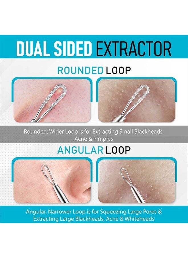 Hula Home - Blackhead Remover Pimple Extractor Popper Tool Acne Comedone Blackhead, Blemish, Whitehead Popping, Zit Removing for Nose Face, 304 - Stainless Steel - Image 1