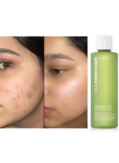Ole Henriksen Olehenriksen Ole Henriksen Balancing Force Oil Control Toner 6.5 Oz  - Image 5