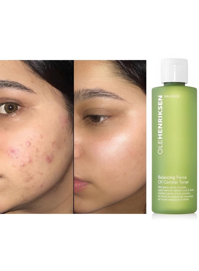 Ole Henriksen Olehenriksen Ole Henriksen Balancing Force Oil Control Toner 6.5 Oz - Image 5