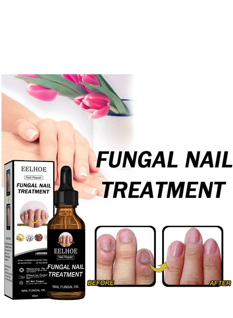 EELHOE Grey Nail Repair Thicken & Shine Nail Moisturising Solution - Image 1