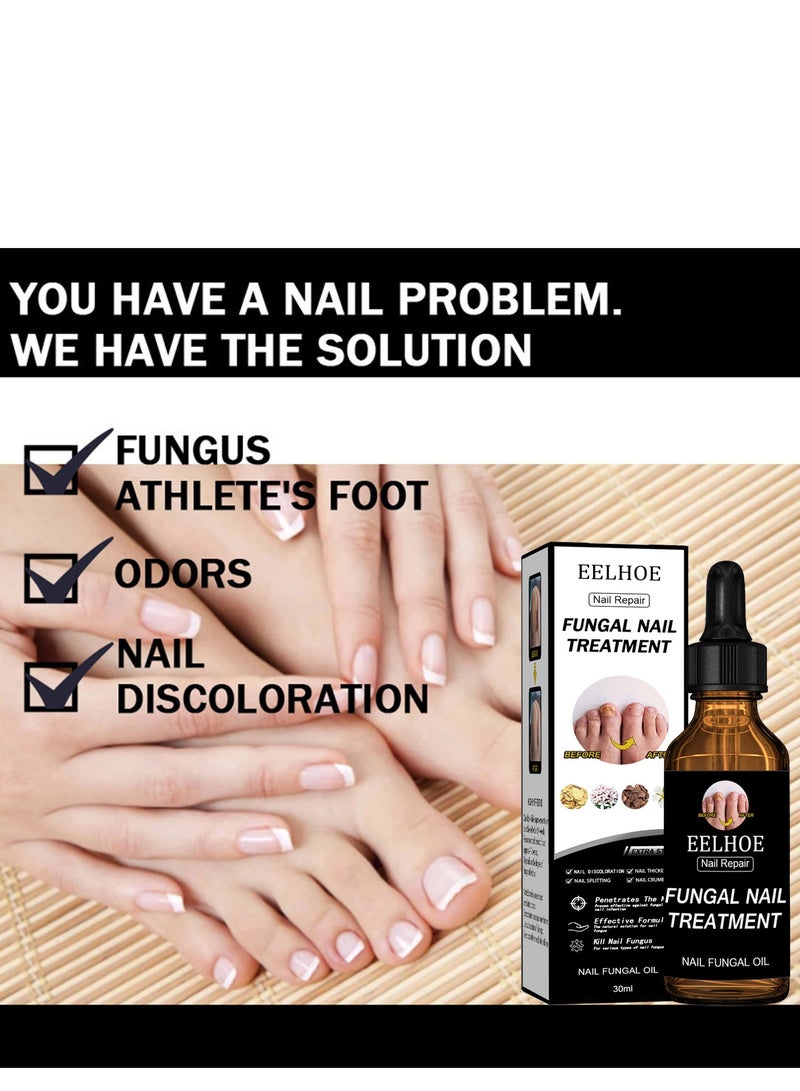 EELHOE Grey Nail Repair Thicken & Shine Nail Moisturising Solution - Image 3