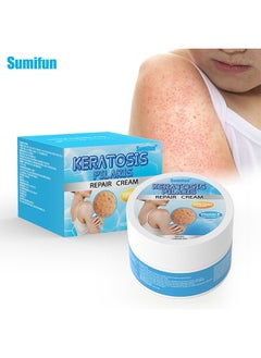 Sumifun Keratosis Pilaris Repair Cream,Vitamin E cream, urea to remove dead skin cells 30g  - Image 1