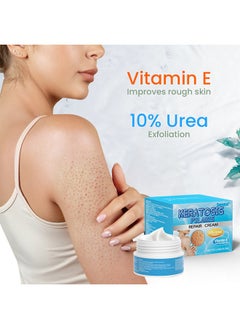 Sumifun Keratosis Pilaris Repair Cream,Vitamin E cream, urea to remove dead skin cells 30g  - Image 3