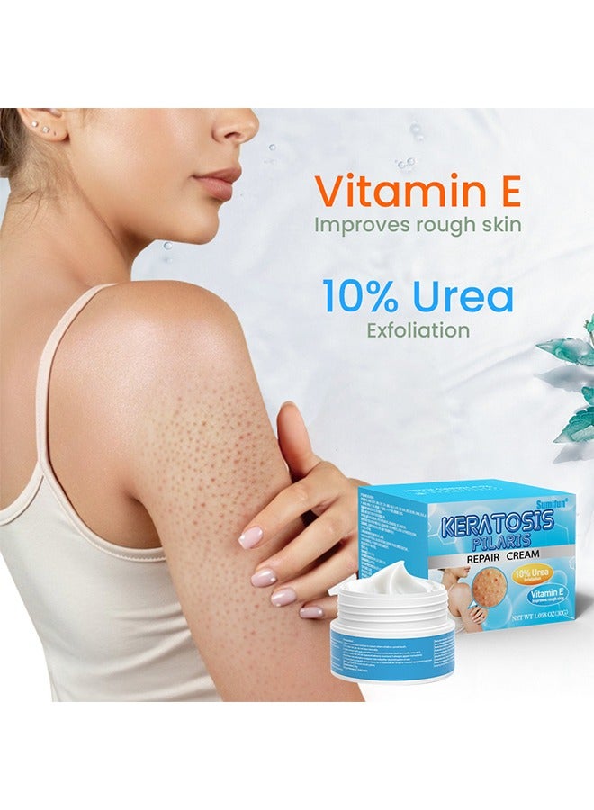 سوميفون كريم إصلاح التقرن بيلاريس ، كريم فيتامين ه ، اليوريا لإزالة خلايا الجلد الميتة 30 جرام - Image 3