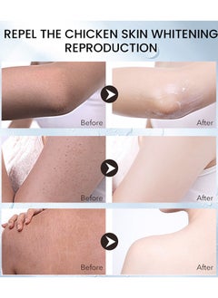 Sumifun Keratosis Pilaris Repair Cream,Vitamin E cream, urea to remove dead skin cells 30g  - Image 5