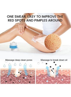 Sumifun Keratosis Pilaris Repair Cream,Vitamin E cream, urea to remove dead skin cells 30g  - Image 4