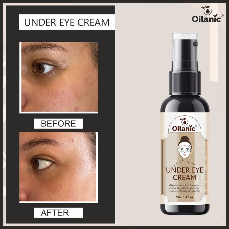 Oilanic Under eye cream for dark circles for women & men| Under eye cream for wrinkles & puffy eyes | Dark circle remover Pack of 4 of 50 ml - Image 5