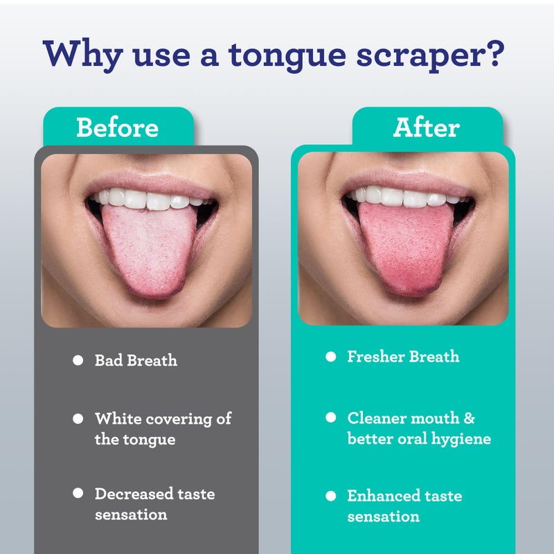GuruNanda Tongue Scraper for Adults (2 Pack) with Travel Case, 420 Medical-Grade 100% Stainless Steel Tongue Cleaner, Aids in Fresh Breath & Oral Care - Image 3
