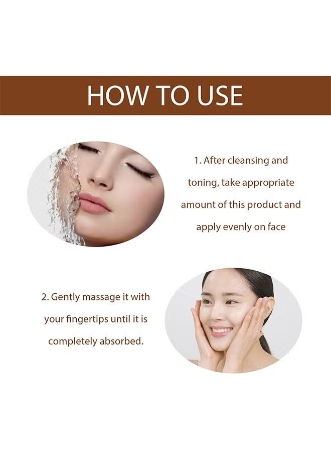 Hoygi Niacinamide Anti Freckle Serum, Niacinamide Spot Correcting Serum | Hydrating, Skin Brightening, Dark Spot Fading & Skin Rejuvenating Essence 30ml - Image 3