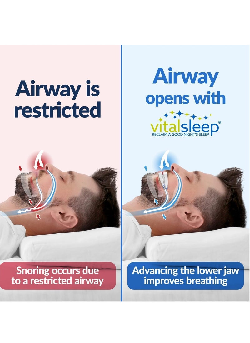Anti Snoring Device and Ear Plugs, Men's Size Customizable Snoring Solution, Stop Snoring Mouth Piece, Adjustable Sleep Guard, USA Made for Restful Sleep