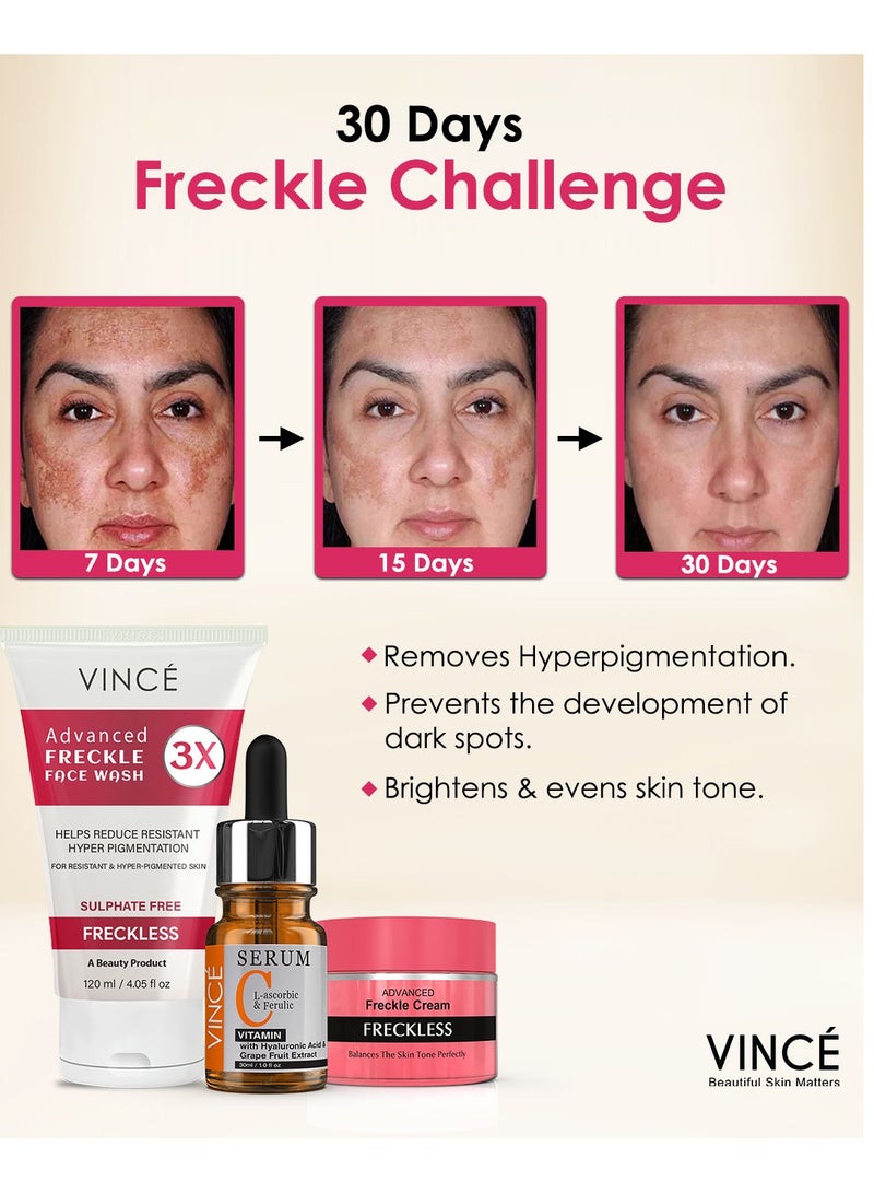 فينس مجموعة مكافحة النمش - مصل فيتامين سي 30 مل + كريم النمش 50 مل + غسول النمش للوجه 120 مل - يقلل من النمش والتصبغ والبقع الداكنة - يكشف عن بشرة أكثر إشراقًا ووضوحًا وتوحيدًا - Image 2