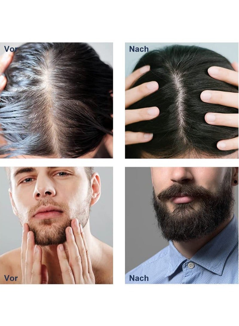 UHOOMA Beard Roller 0.25 mm - 540 Titanium Real Needles for Ultra Beard Growth - More Beard Growth with Beard Roller Beard Roller Face Roller Derma Roller - Microneedle Tool - Image 5