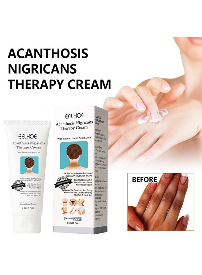إيلهو كريم علاج Acanthosis Nigricans - مع حمض اللاكتيك ، كريم الريتينول الذي تم اختباره من قبل أطباء الأمراض الجلدية ، كريم إزالة فرط التصبغ ، لأجزاء الجسم الداكنة مثل مفاصل الكاحلين في الرقبة والإبطين 50 جرام - Image 1