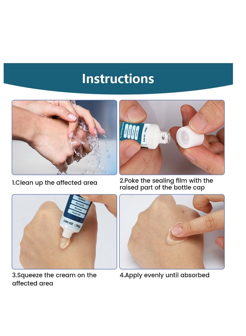 سوميفون جل الندبات، علاج ندبات حب الشباب، إزالة ندبات حب الشباب العميقة، حروق كيلود hypertrophic، كريم إزالة الندبات، إصلاح البشرة التالفة، إزالة علامات حب الشباب، كريم إصلاح الندبات 30 جرام - Image 3