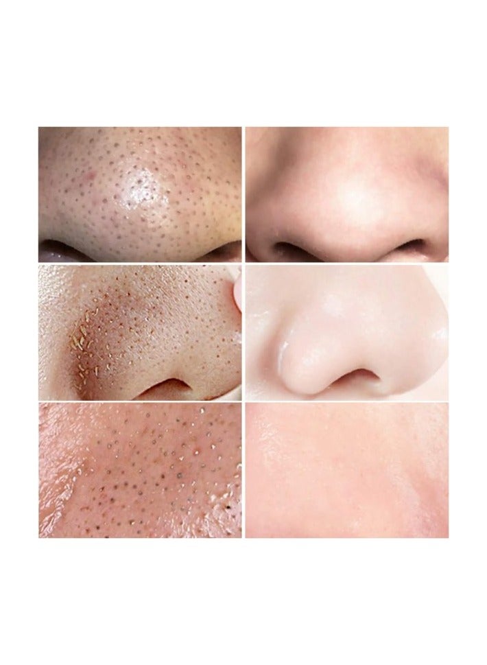 LANBENA Lanbena Blackhead Remover Mask 100 Strips - Image 2