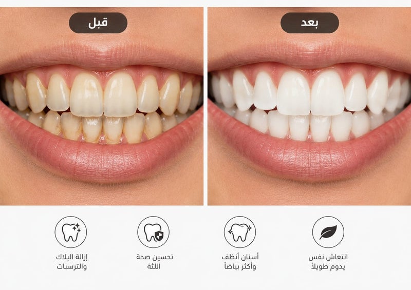 فرشاة اسنان فرشاة كهربائية, مجموعة العناية بالفم القابلة للشحن - مجموعة تنظيف الأسنان وتبييضها للاستخدام المنزلي 31000 - Image 4