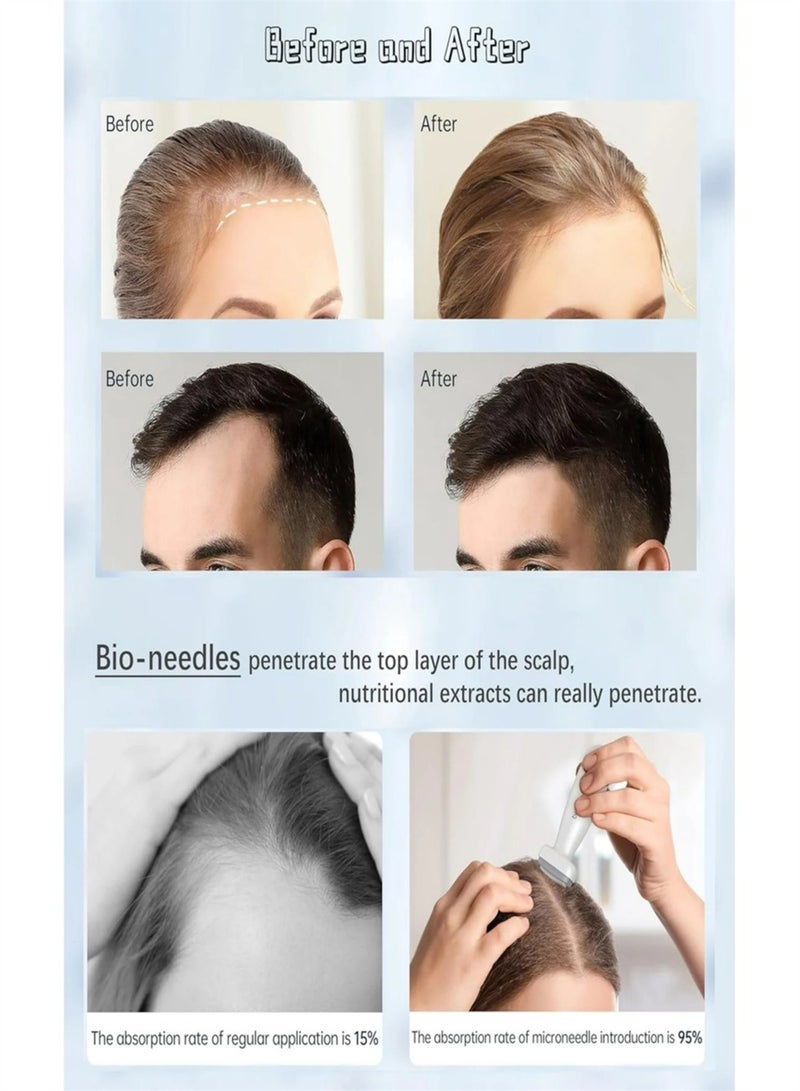 bio needle Adjustable Dermal Stamp Microneedle Stamp Microneedle Skin Pen 0.25mm for Face Scalp Beard Body - Image 4