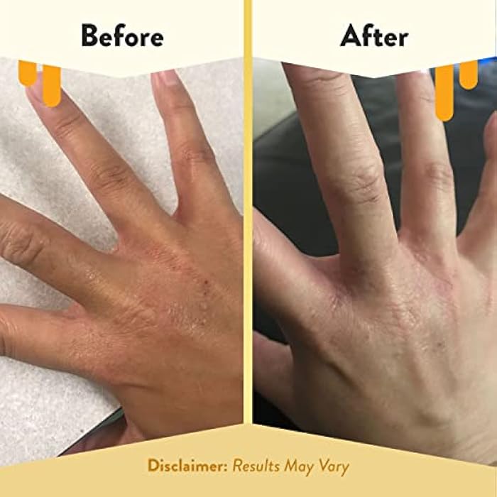 ECZEMA HONEY Premium Witch Hazel & Aloe Spray - Facial Mist Skin Care Product - Unscented Moisturizer, Dewy Makeup Spray, Aftershave & More (8 Oz) - Image 4