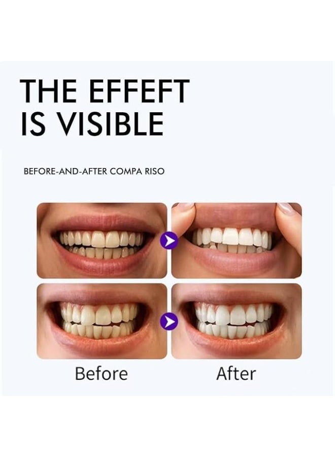 28 pcs V34 Purple Optical Teeth Whitening Strips Enamel Safe Daily Use Whitener for Sensitive Teeth Deep Stains Removal Tooth Whitening Brighten Smile Non-Slip Dry Strip Technology for Whiter Teeth - Image 3