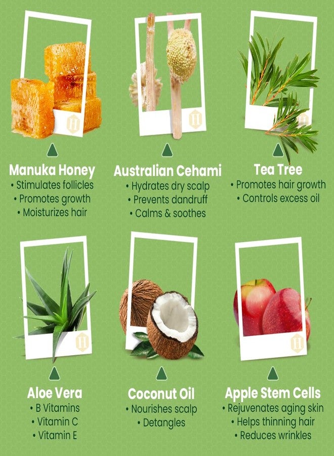 Honeyskin Tea Tree & Honey Shampoo & Conditioner Set - Dandruff Treatment With Organic Tea Tree Oil - Itchy Scalp Treatment for Women & Men - Sulfate and Paraben Free With Manuka Honey Aloe Vera & Coconut (8oz) - Image 2