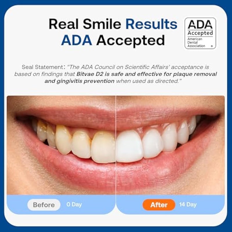 Bitvae D2 Ultrasonic Electric Toothbrush for Adults and Kids, Electric Toothbrush with Rechargeable Power, 8 Toothbrush Heads and 5 Modes, Black - Image 2