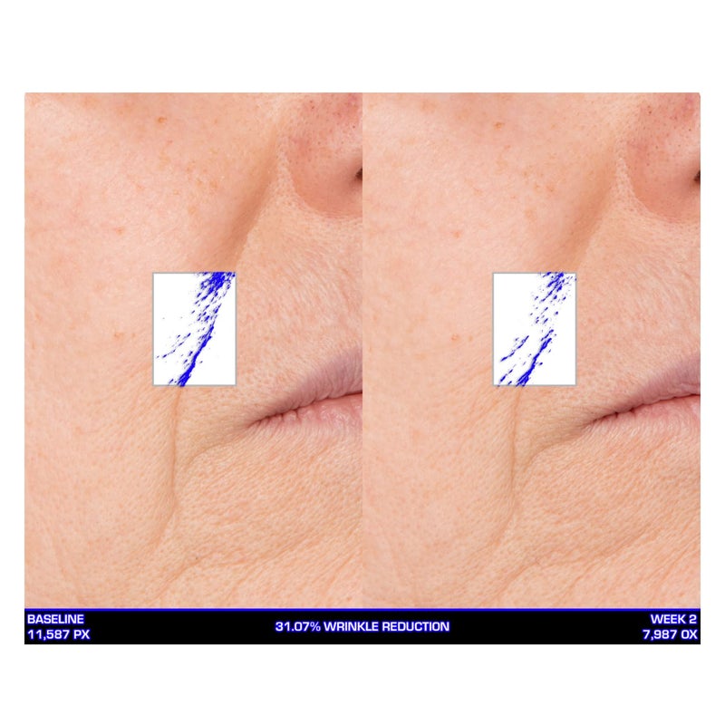 Serious Skincare Ultra-Mare Pure Marine Infusion Facial Serum - Encourages Collagen Production, Cell Turnover and Plumper Skin - Niacinamide - Acid Free - Concentrated 2 oz. - Image 4