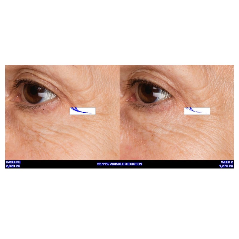 Serious Skincare Ultra-Mare Pure Marine Infusion Facial Serum - Encourages Collagen Production, Cell Turnover and Plumper Skin - Niacinamide - Acid Free - Concentrated 2 oz. - Image 2