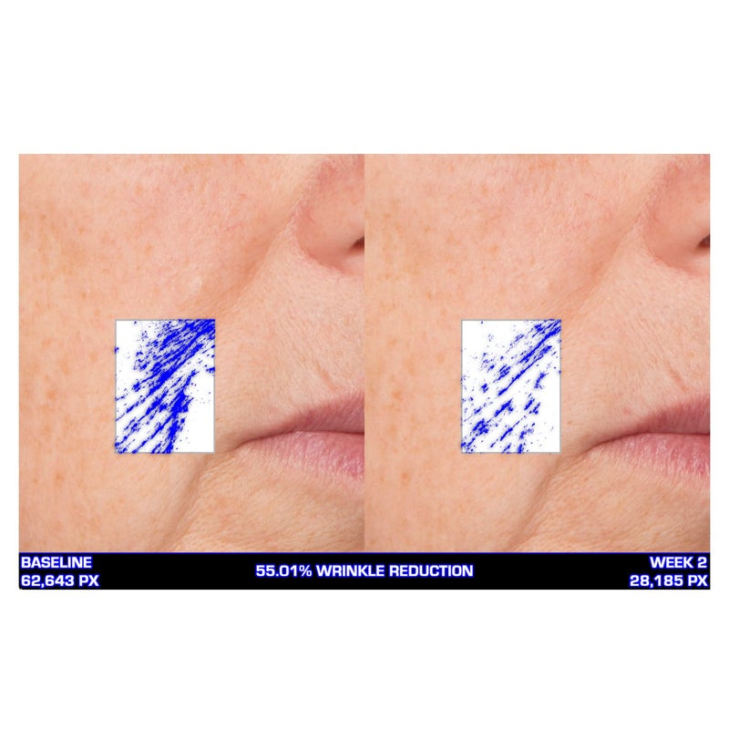 Serious Skincare Ultra-Mare Pure Marine Infusion Facial Serum - Encourages Collagen Production, Cell Turnover and Plumper Skin - Niacinamide - Acid Free - Concentrated 2 oz. - Image 3