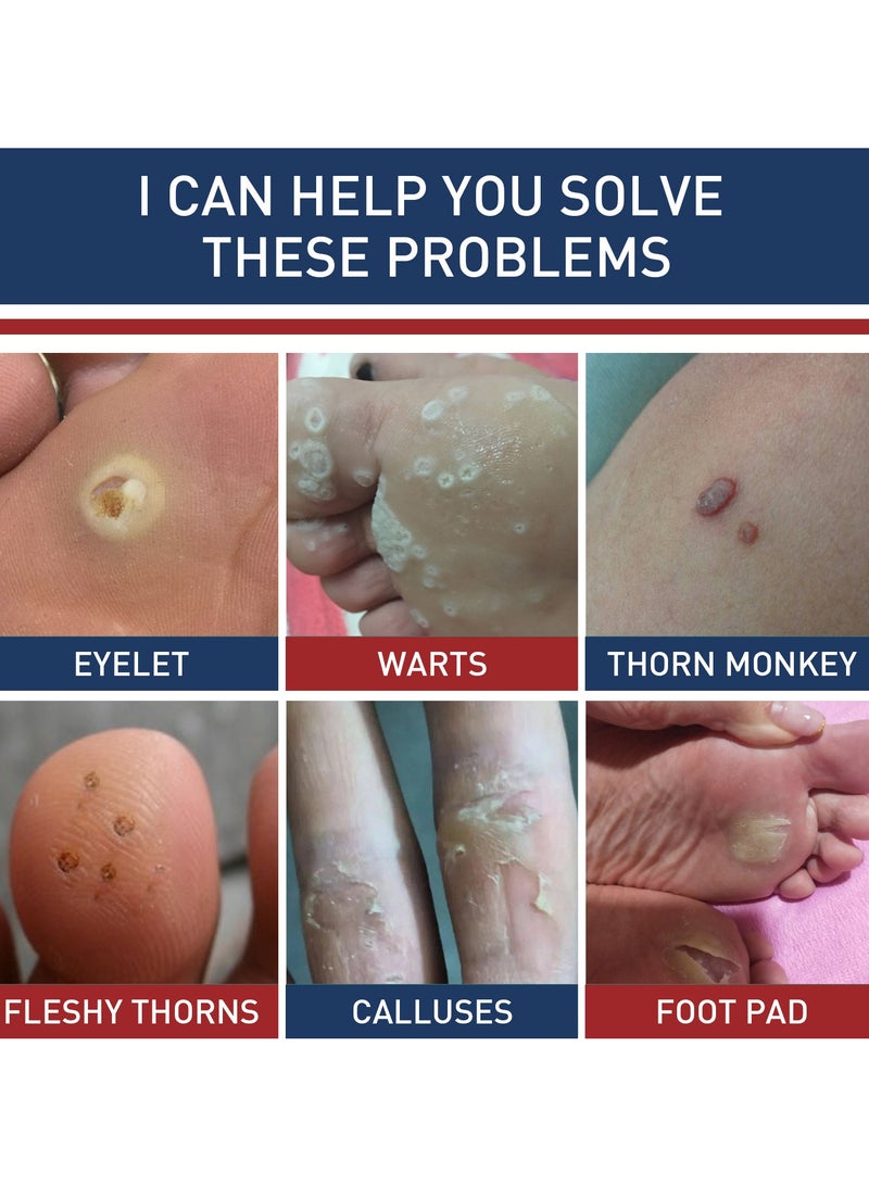 ام كيو وسادات تقشير مسامير القدم من MQ، 24 قطعة/صندوق - Image 4