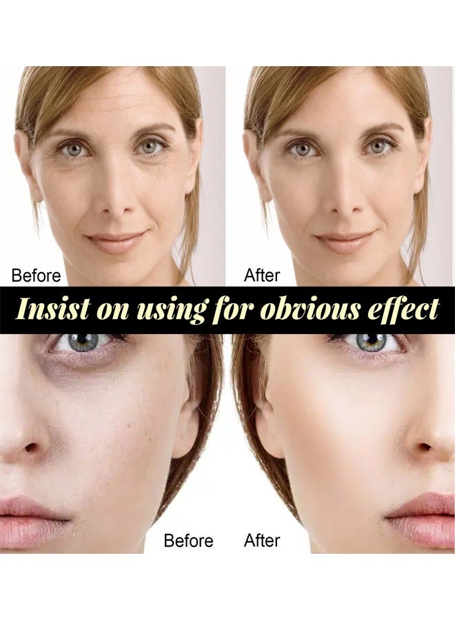 EELHOE Instalift Protein Thread Firming Set, the Golden Protein Lines for the Face and Neck Promote Younger-Looking Skin, Perfect for All Skin Types, Especially Dry Skin, Improve Skin Elasticity - Image 4