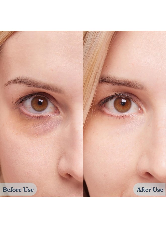 Le Gushe - Under Eye Patches - 24K Gold Under Eye Mask Anti-Aging Hyaluronic Acid Collagen Under Eye Pads Reducing Dark Circles & Wrinkles Treatment Gel Bags - Image 1