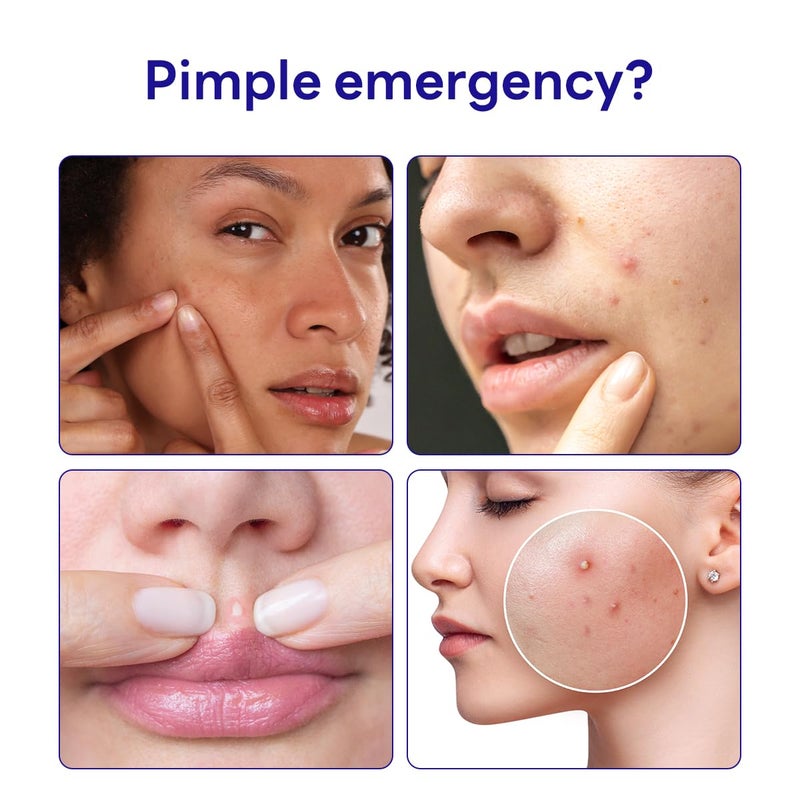 Mediheal Derma Clear Teatree Treatment Spot Patch (44 Counts) - Acne Relief, Oil and Moisture Balance with Teatree & Salicylic Acid - Image 2