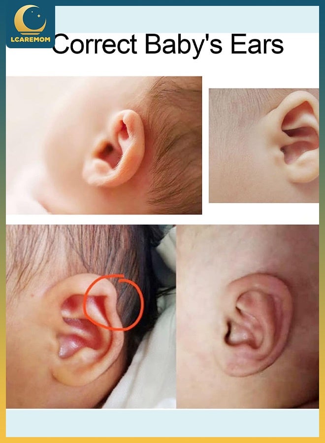 LCAREMOM Baby Auricle Valgus Correction Patch, Infant Ear Correction,Silicone Newborn Baby Ear Aesthetic Correctors, Protruding Ear Stickers for Newborns, Kids, and Babies - Adjustable & Skin-Friendly - Image 5