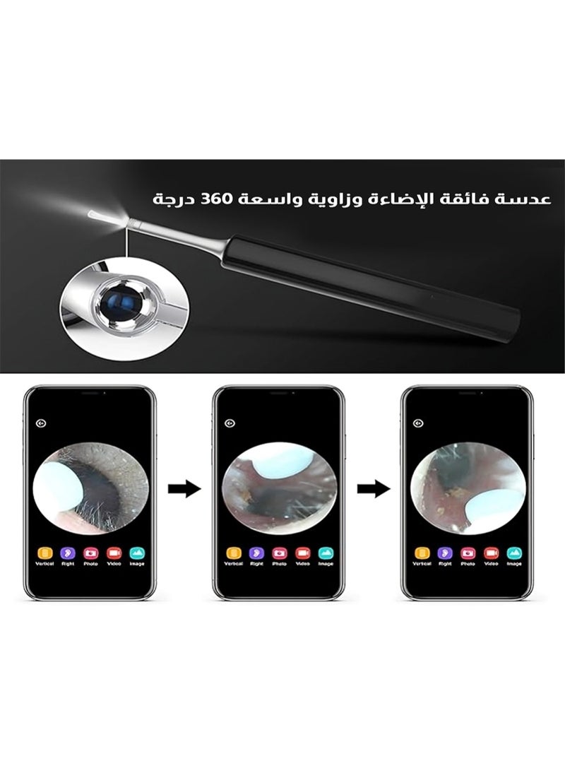 Relax Smart Smart Earwax RemoSmart Visual Ear Wax Removal Kit – HD Otoscope with Camera & LED Light, Safe Ear Cleaning Stick with App Connectivity for Adults and Kidsval Tool R1 - Image 5