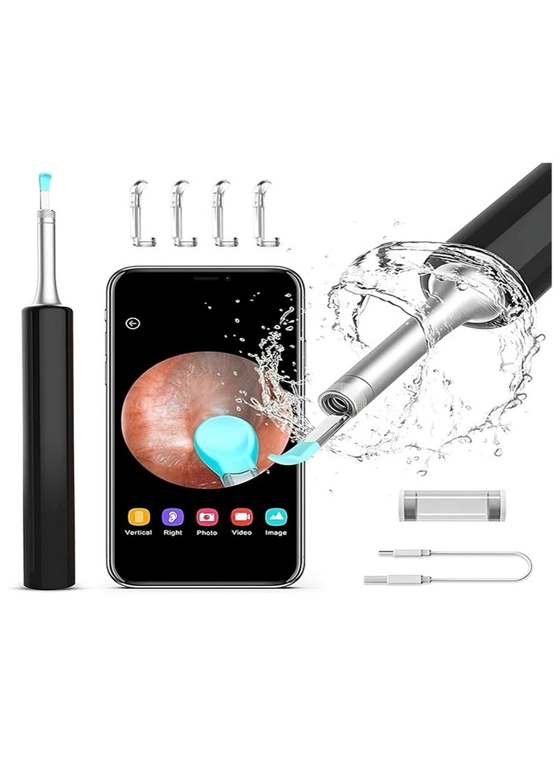 Relax Smart Smart Earwax RemoSmart Visual Ear Wax Removal Kit – HD Otoscope with Camera & LED Light, Safe Ear Cleaning Stick with App Connectivity for Adults and Kidsval Tool R1 - Image 1
