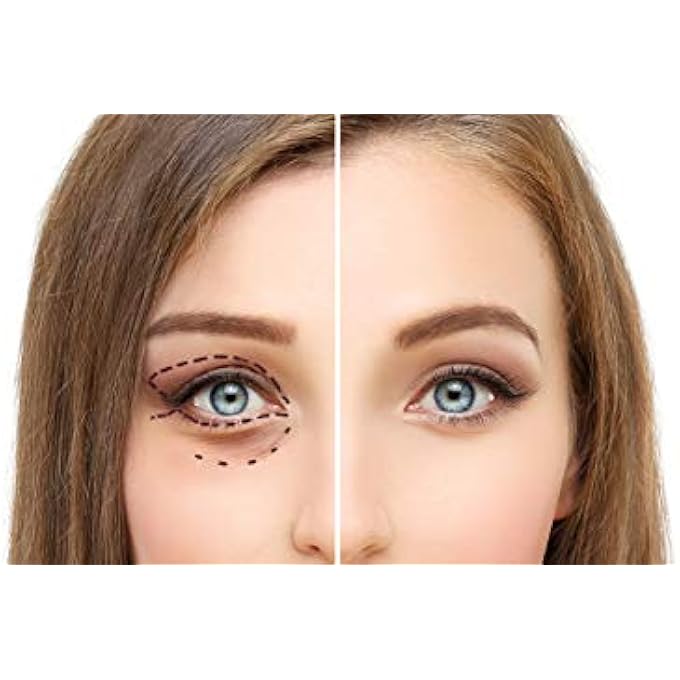 Osmotics Cosmeceuticals Under Eye Rejuvenator, Anti Aging Eye Cream For Dark Circles, Eye Bags, Fine Lines, Puffiness. Best Anti Aging Eye Cream for Wrinkles, Crows feet, And Puffy Eyes - Image 2