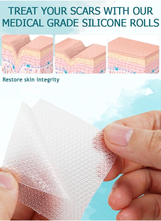 NIKITA.VIVI Clear Silicone Scar Sheets 1.5M Medical Grade Clear Gel Scar Tape Silicone Scar Strips Effective Scars Away Invisible Silicone Scar Sheets for Surgical Scars C Section Burn  - Image 4